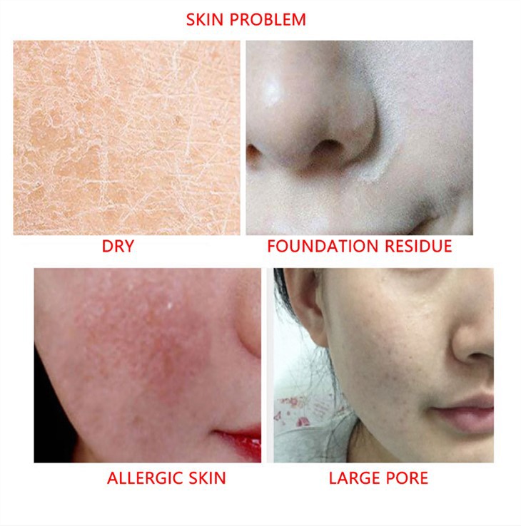 turmeric face wash for acne